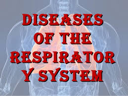 3D mapping makes respiratory diseases treatment easy 3D mapping makes respiratory diseases treatment easy