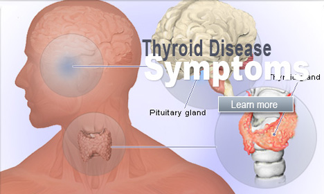 New Delhi : Only 5 percent pregnant women get counselling for thyroid disorders New Delhi : Only 5 percent pregnant women get counselling for thyroid disorders