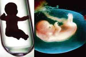Fetal Sex Disclosure : Do we need alternative view on PCPNDT Act? Fetal Sex Disclosure : Do we need alternative view on PCPNDT Act?